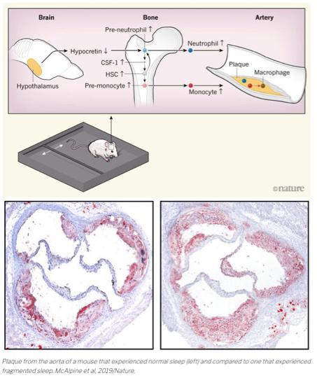 McAlpine et al. Nature 2019 Nature paper showing sleep disruption contributes to cardiovascular disease